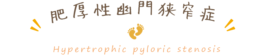 肥厚性幽門狭窄症